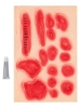 Picture of Set heridas infectadas